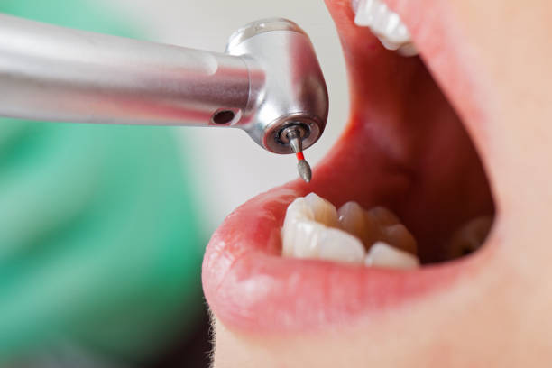 Best Broken or Chipped Tooth Repair in Lakeview, NY